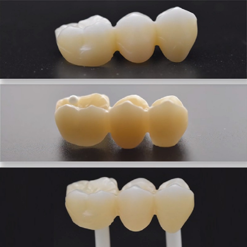 71 mm 4D meerlaagse zirkoniablokken