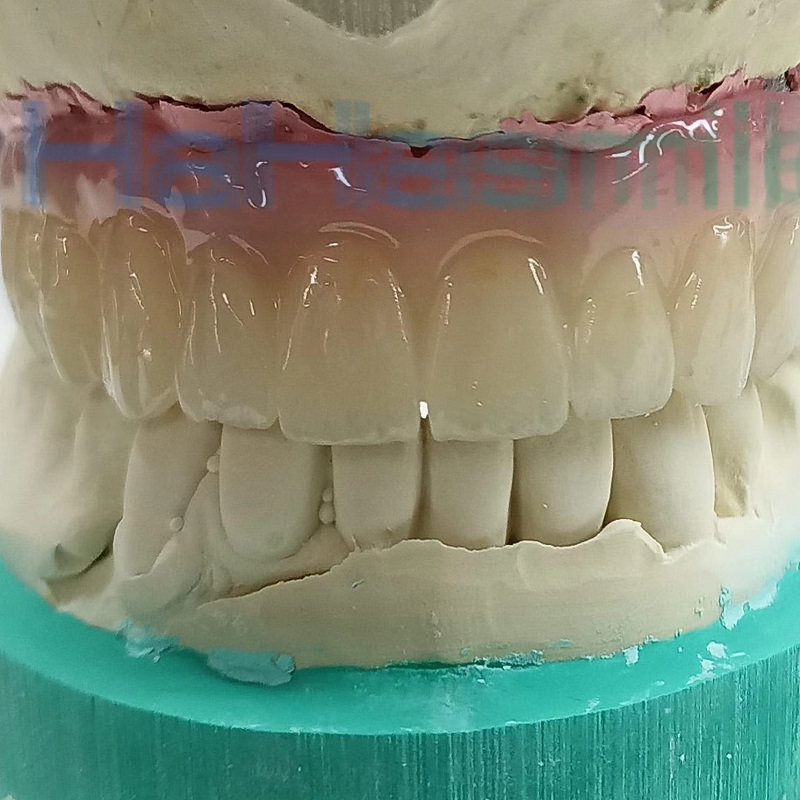 71 mm 4D meerlaagse zirkoniablokken